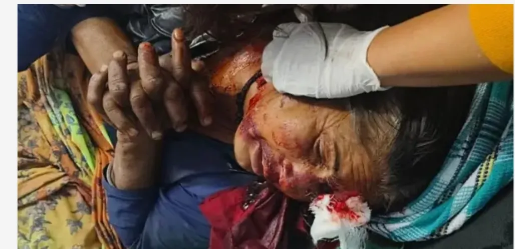 बड़ी खबर: लैंसडौन में महिला पर जंगल में अचानक भालू ने किया हमला,  गंभीर हालत में एम्स ऋषिकेश रेफर