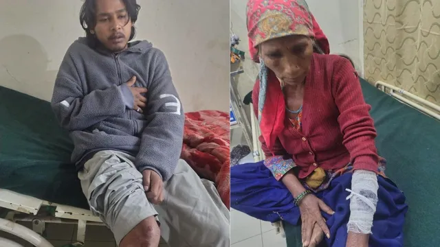 चमोली में भालू का हमला, एक ही परिवार के चार लोग घायल; हायर सेंटर रेफर